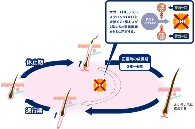 発毛
